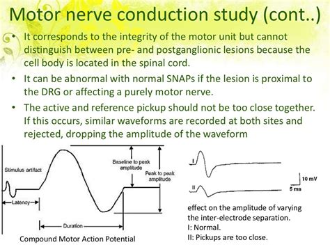 bell's palsy nerve conduction study